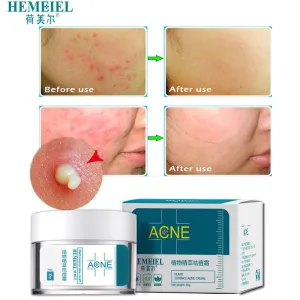 HEMEIEL Herbal Anti-Acne Cream Oily Skin Acne Stains Moisturizing Acne Treatment Face Cream Care Acne Scar Remove Blackhead