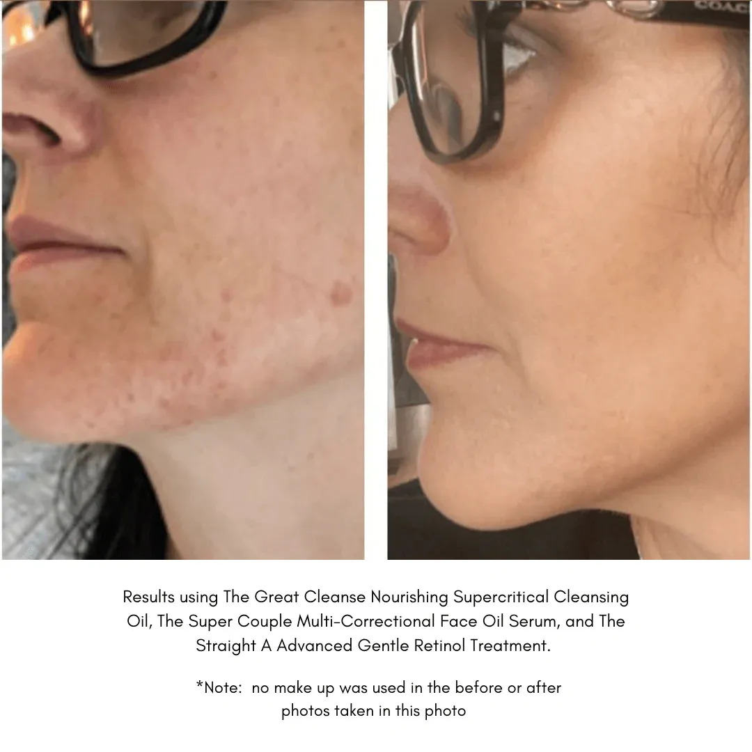 THE GREAT CLEANSE – Nourishing Supercritical Cleansing Oil